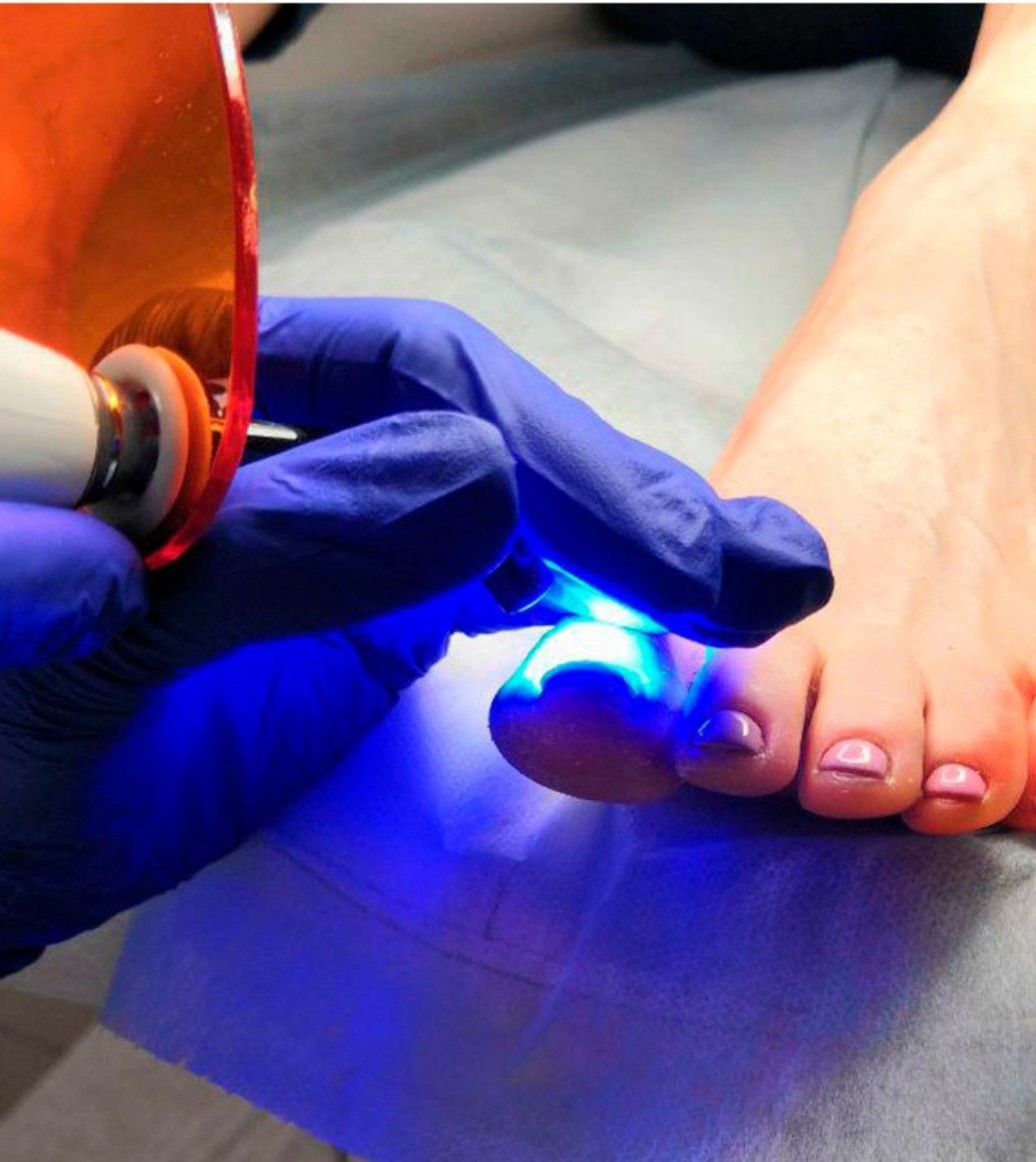Pedicure Clínico en Tijuana - Pedi Medi Las Palmas