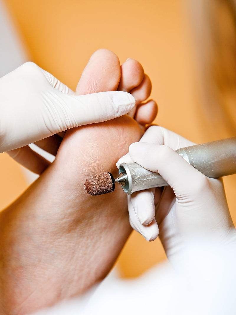 Tratamiento Pie Diabético en Tijuana - Pedi Medi Tijuana